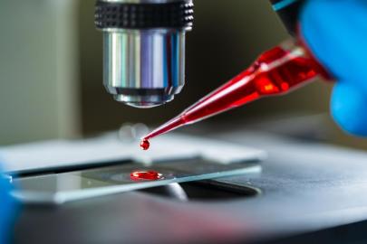 Türkiye'nin ilk yerli ve milli gen tedavisi için tarihi adım