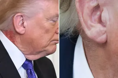Trump'ın boynundaki kızarıklığı gizleme çabası