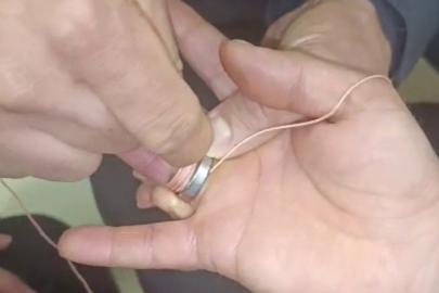 İtfaiye ekipleri parmağa sıkışan yüzüğü çıkardı